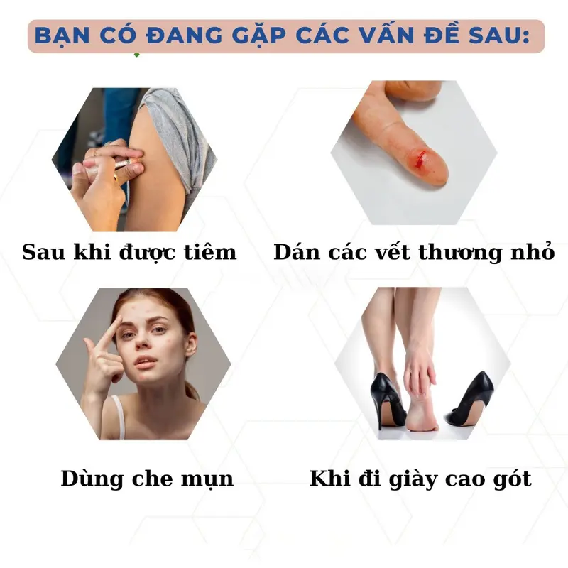 Hộp 100 miếng băng keo cá nhân Dieulinhshop hoạ tiết hoạt hình thoáng khí siêu dính chống thấm nước 1