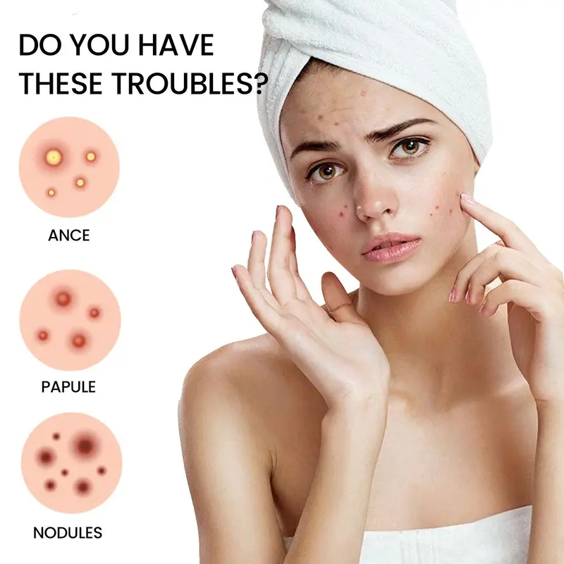 Star Shaped Acne Patches, 5 Sheets/box Hydrocolloid Acne Covering Patches, Facial Skin Care Products for Women & Men 5