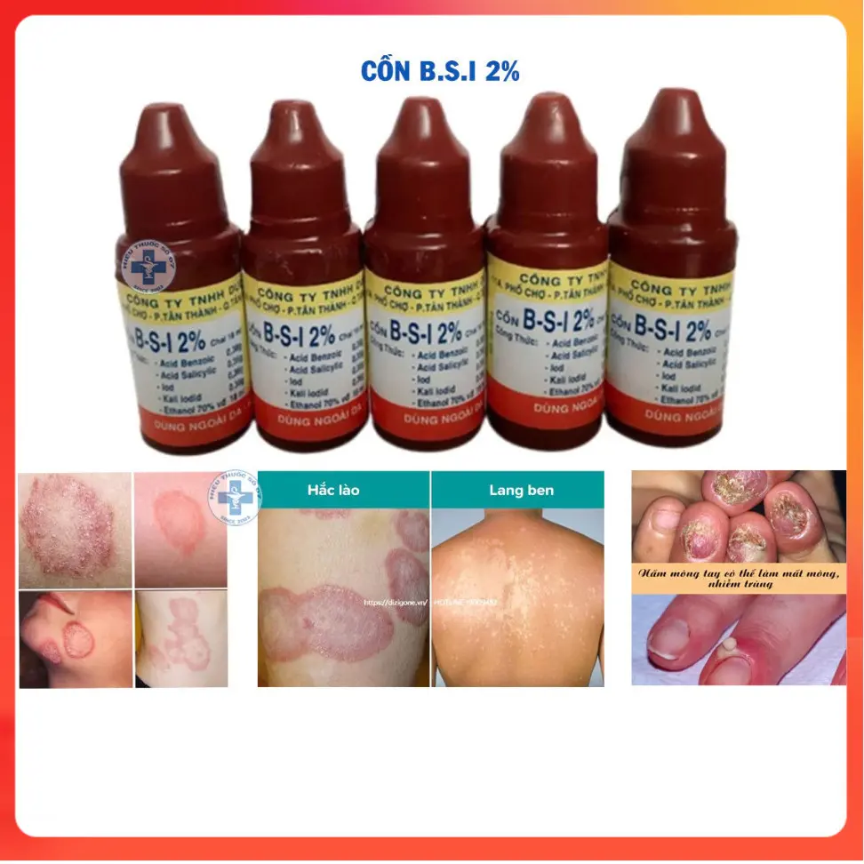 Cồn B.S.I 2%, cồn bsi giúp giảm lang ben,  hắc lào, nấm da, nấm móng tay chân - chai 18ml y tế hatoto