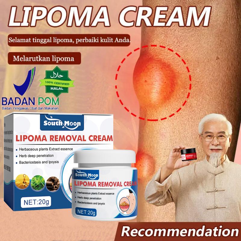 Salep Lipoma [IMPORT ASLI] Krim Lipoma Benjolan di Tubuh Penghancur Benjolan Kelenjar Getah Bening