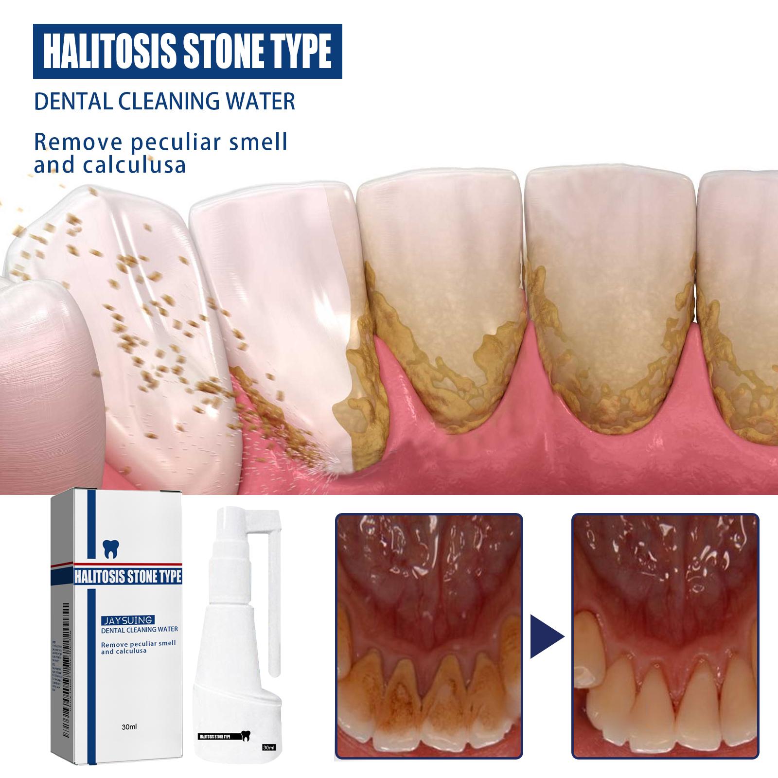 Penghilang Tartar Kecantikan Penghilang Tartar Keras 30ml Alat Pembersih Tartar Pemutih Gigi Penghilang Tartar Kuning Penghilang Tartar Permanen Efektif Pemutih Gigi Menghilangkan plak gigi dan noda asap menghilangkan bau mulut [C10]