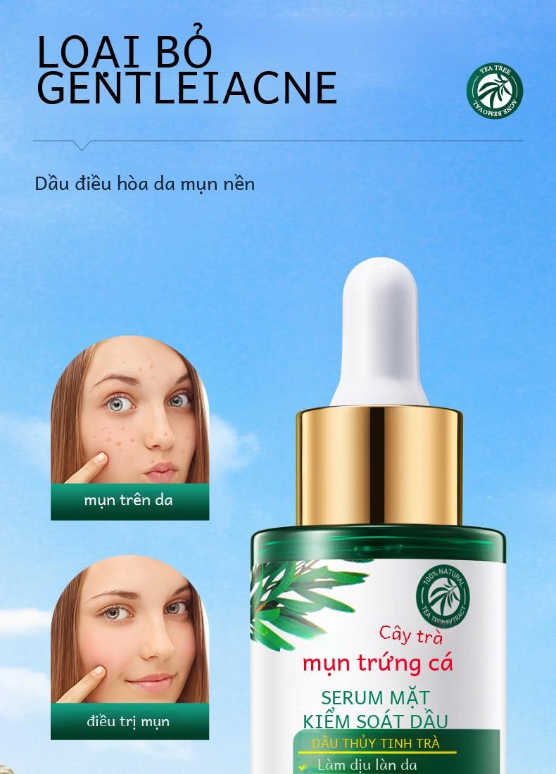 Product Introduction of Bộ Chăm Sóc Da Cây Trà, SADOER, 5 Món, Làm Sạch, Dưỡng Ẩm, Dưỡng Ẩm Skincare Làm Đẹp Da Serum Cho Bé sữa _ 16