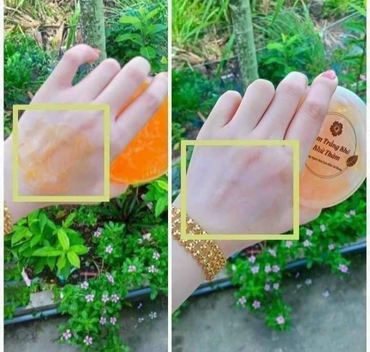 Product Introduction of Serum kích trắng khửu thâm 500gr - Tắm trắng khô hỗ trợ da thâm - Không đều màu - Cấp ẩm da 0