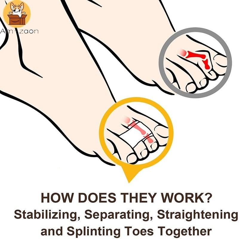 Nẹp Chỉnh Sửa Ngón Chân Với Miếng Lót Gel Và Miếng Đệm Gót Chân, Thoải Mái Khi Đi Bộ, Chỉnh Sửa Ngón Chân Búa, Am-az 5