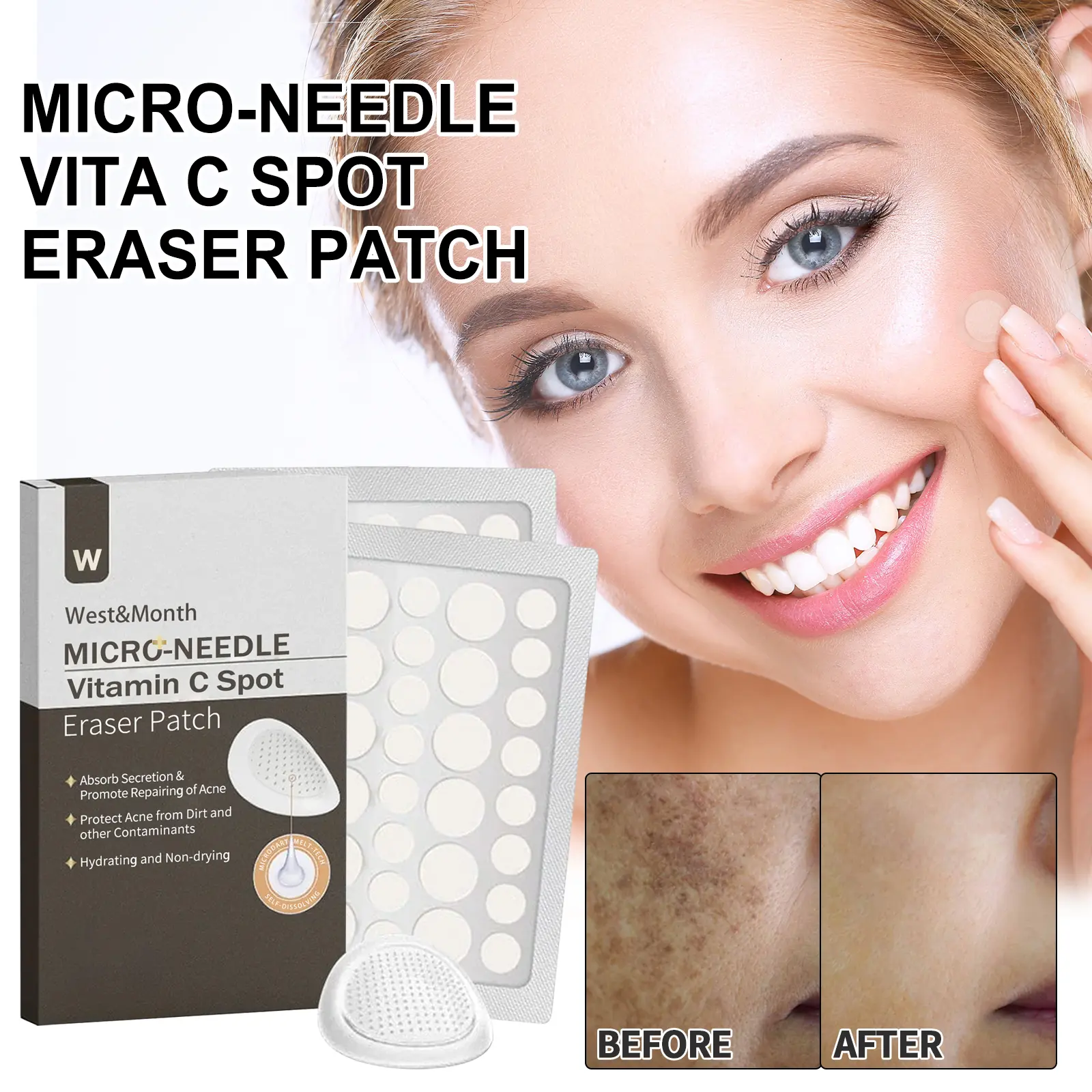 West&Month Micro-needle Vita C Spot Eraser Patch, Fade Spots Acne Print Blemishes Cover Spots Repair Patch