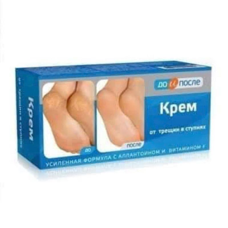 Kem bôi nứt , nẻ gót chân kpem hàng nga 50ml 0