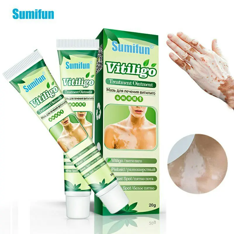 Obat Penghilang Vitiligo Salep Krim Vitiligo Kulit Bercak Belang Bintik Putih Paling Ampuh 20 gr Bebas Paraben 0
