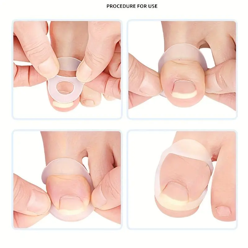Soft Silicone Nail Groove Corrector, 2 Counts Comfortable Nail Corrector Suitable for All, Manicure & Pedicure Tools for Home & Salon Use 6