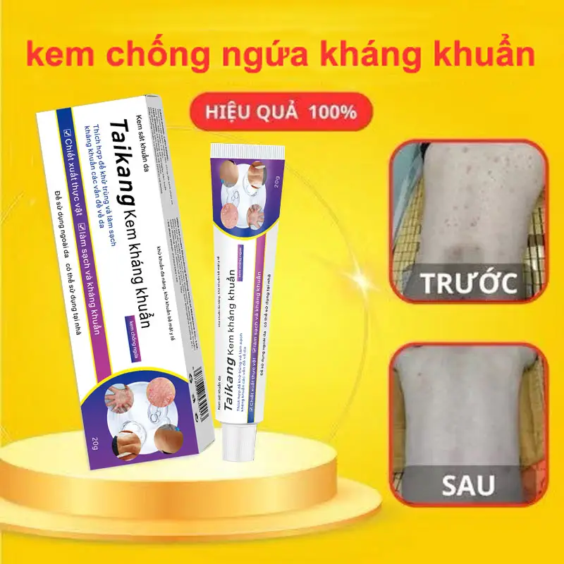 TAIKANG Giảm ngứa da dị ứng, viêm da thần kinh, viêm da tiếp xúc, viêm da tiết bã, chàm mãn tính, kháng khuẩn và giảm ngứa, chàm, viêm da, muỗi đốt, vẩy nến, viêm sắc tố