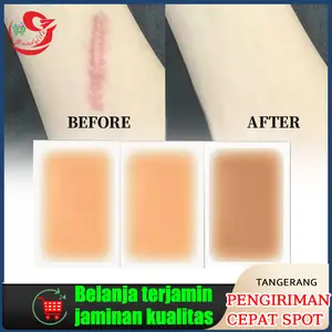 6 Pcs Penutup Tattoo Covering Patch/Koyo Kulit Palsu/Covering Patch Tato/Jepang Tato Penutup Artefak/Daging Bekas Luka Penutup Stiker/Stiker Tak Terlihat/Benjolan Bekas Luka Tanda Lahir Stiker Tato Jerawat/Concealer Penutup Tahan Air Stiker