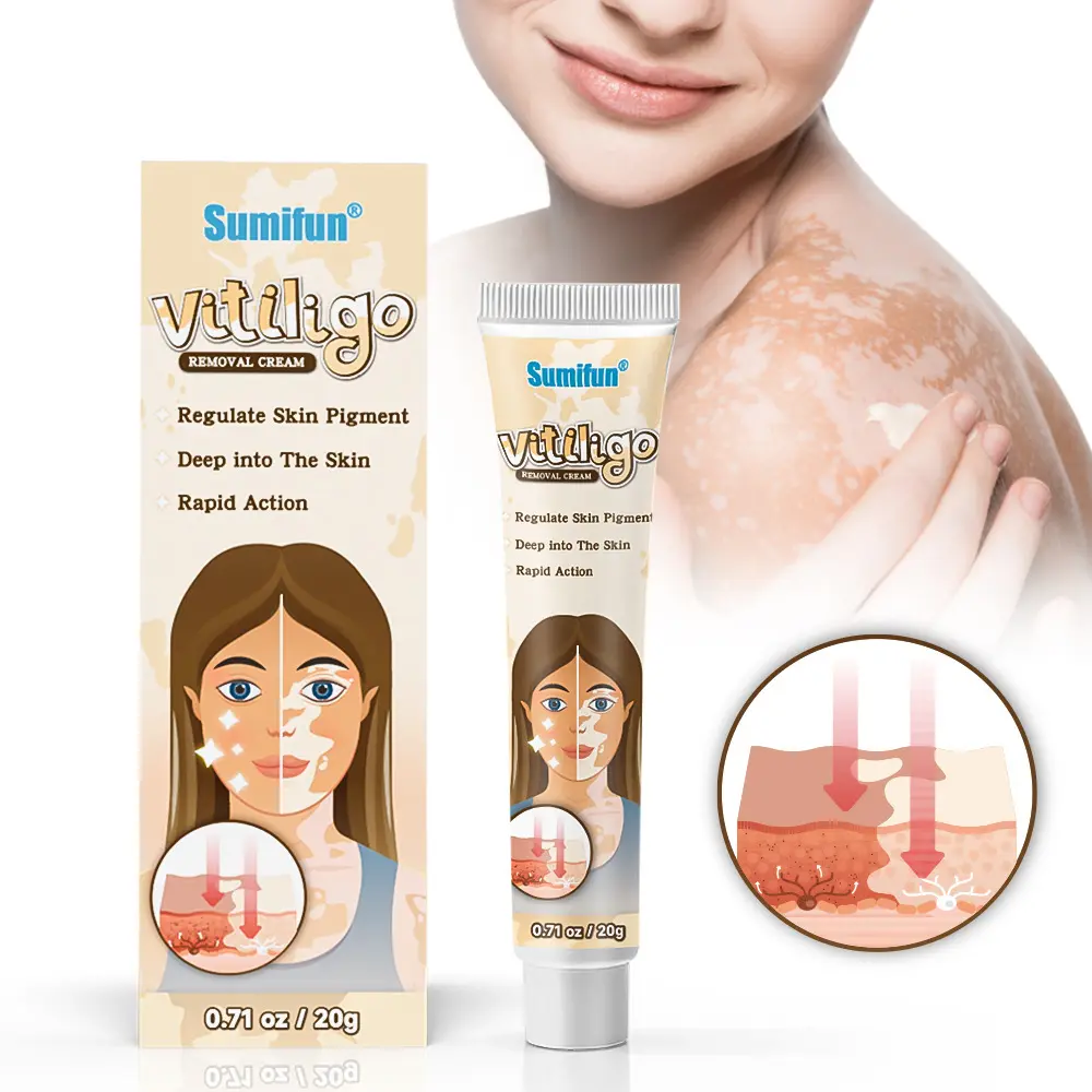Kem làm sạch đốm trắng, để Phục hồi Vitiligo, kem chăm sóc da