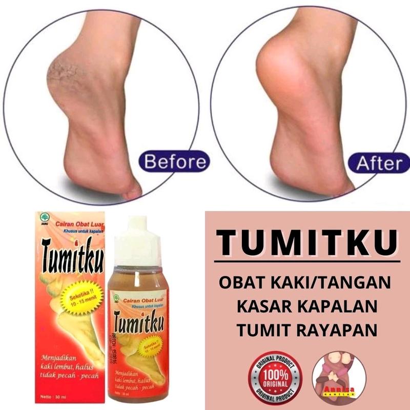 TUMITKU / TUMIT KU UNTUK KAKI PECAH PECAH 2