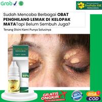 Gambar Propolis sm Untuk Xanthelasma Di Mata Pengendapan Kolesterol Di Kelopak Mata - Propolis sm dari Shakti Herbal Shop Kota Administrasi Jakarta Pusat 1 Tokopedia