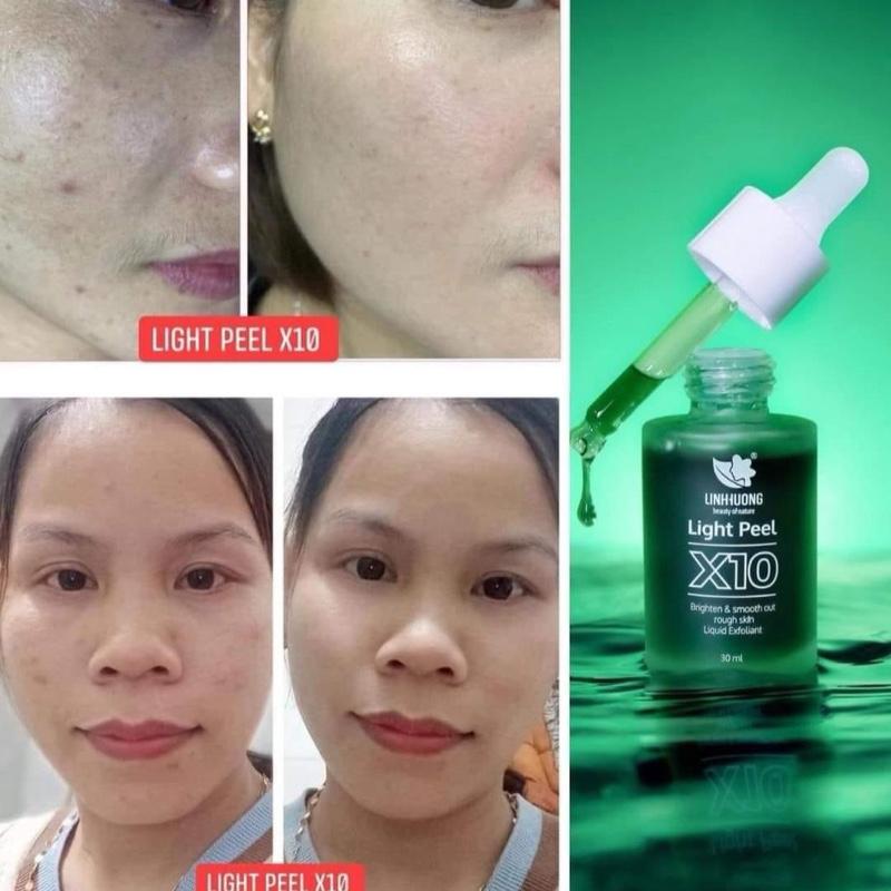 TÁI TẠO DA X10 Linh Hương ( Date 3 Năm hàng ch/hãng) 3