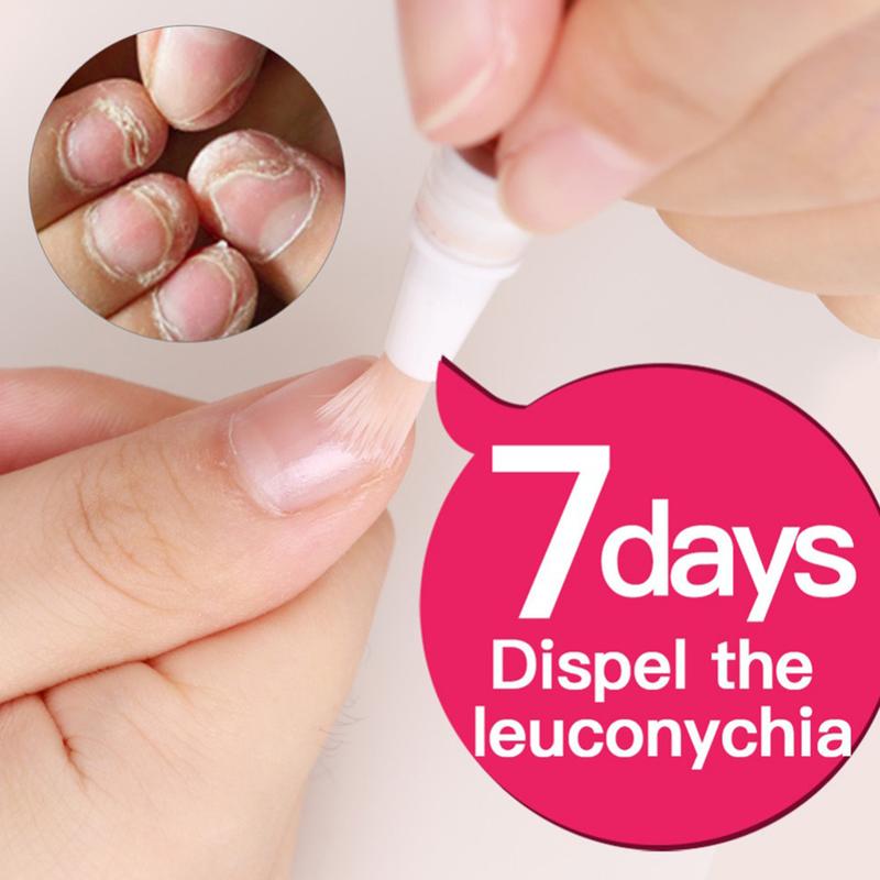 Product Introduction of 3ml Fungal Nail Pen Effective Onychomycosis Paronychia Fungus Infection Repair S 96