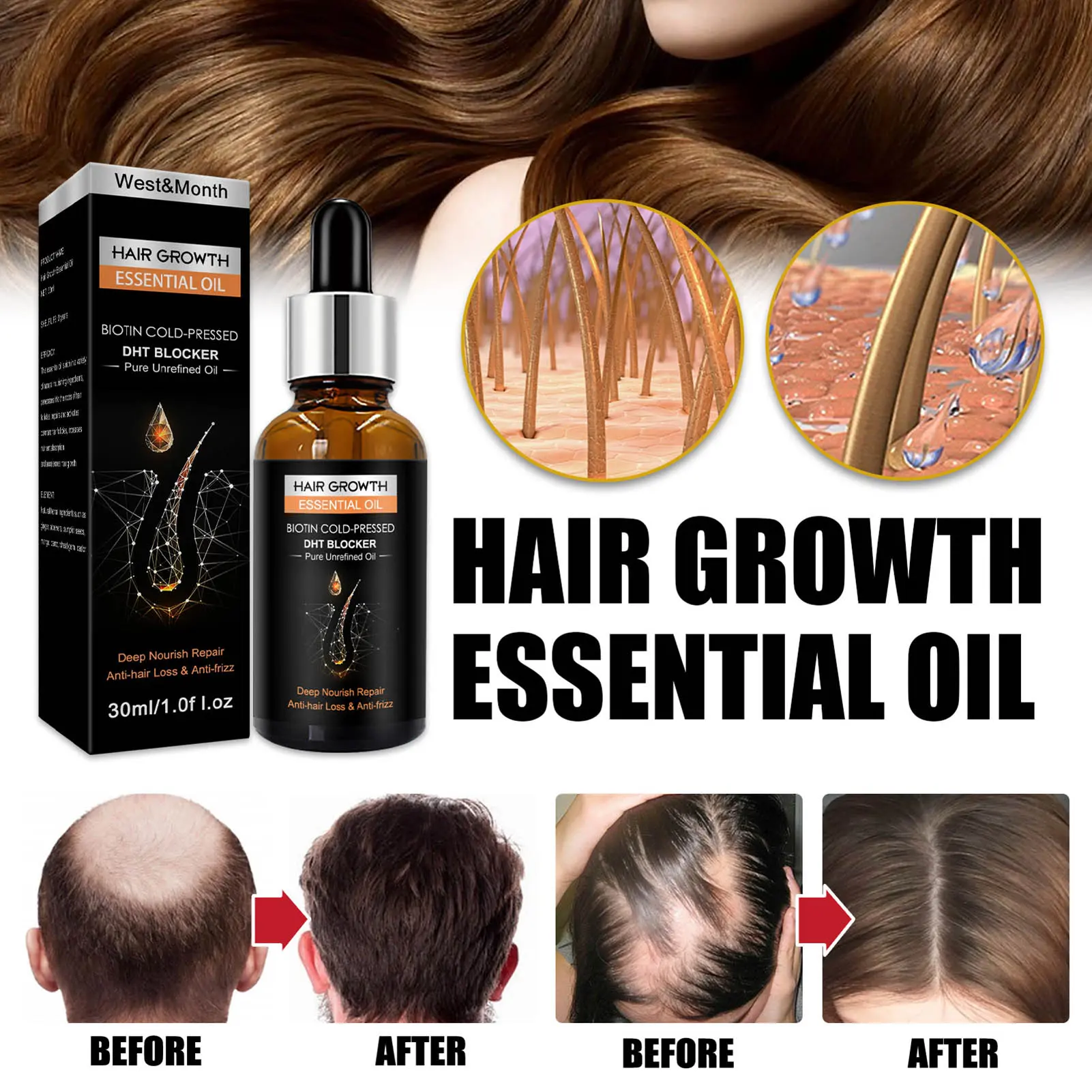 Leiing-30ML Hair Oil Safe Ingredients Deep Nourishing Daily Using Anti Hair Loss Hair Growth Essential Oil Household Supplies