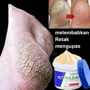 ”Ditambahkan 100% esensi perbaikan“Krim kaki pecah-pecah asli krim kaki krim kaki krim kaki obat kaki pecah-pecah tumit kering pecah-pecah