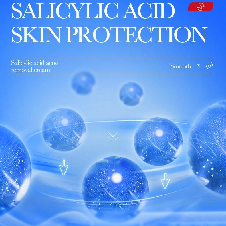 Kem loại bỏ mụn axit salicylic nhanh chóng loại bỏ mụn bọc Giảm Mụn Đầu Đen Và Mụn Trứng Cá 20g 6