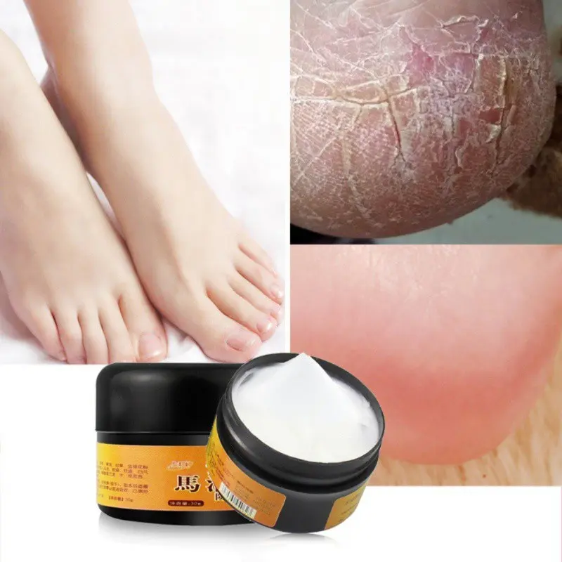 Horse Oil Foot Cream Anti Chapping Rough Dry And Cracked Feet Heel Cream