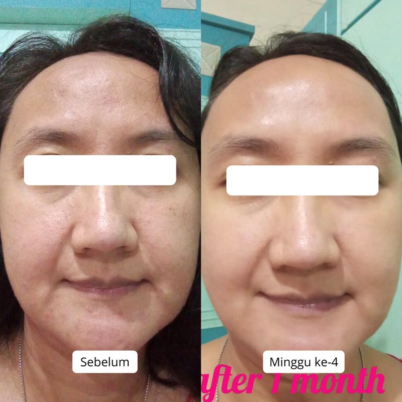 CALLISTA Brightening Essentials Package - Paket Basic untuk Mencerahkan 3