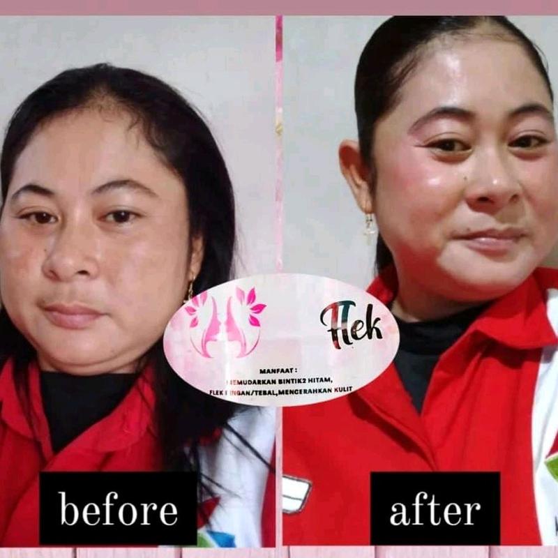 crem flek,glow,acne SPF 30 Semua Jenis Kulit 6