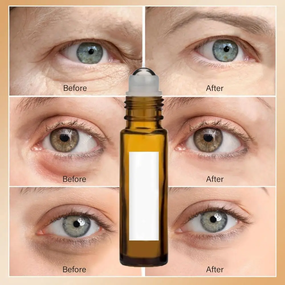New Castor Oil Eye Serum With Frankincense Reduces Fine Lines Eye Roller Ball Under Eye Anti Wrinkle Anti Wrinkle Serum For Eye
