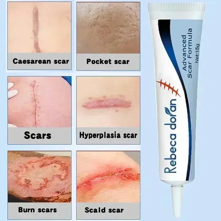 Product Introduction of Maternity Cream That Enhances Elasticity, Gentle Skin Care After Pregnancy, Eliminates Stretch Marks, and Is Very Effective body  moisturizers 9