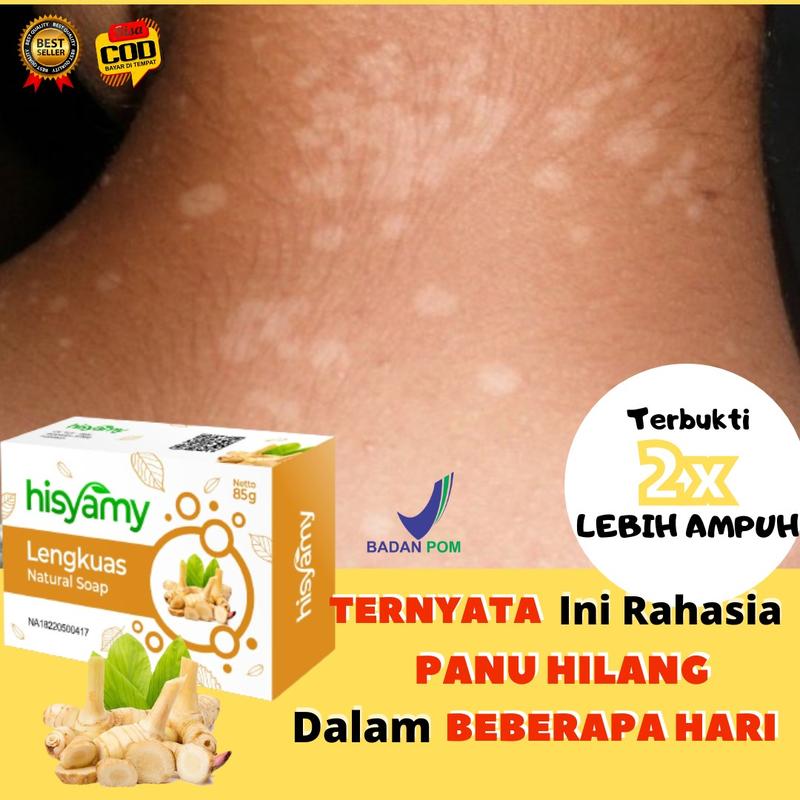 Sabun Lengkuas Penghilang Panu 0
