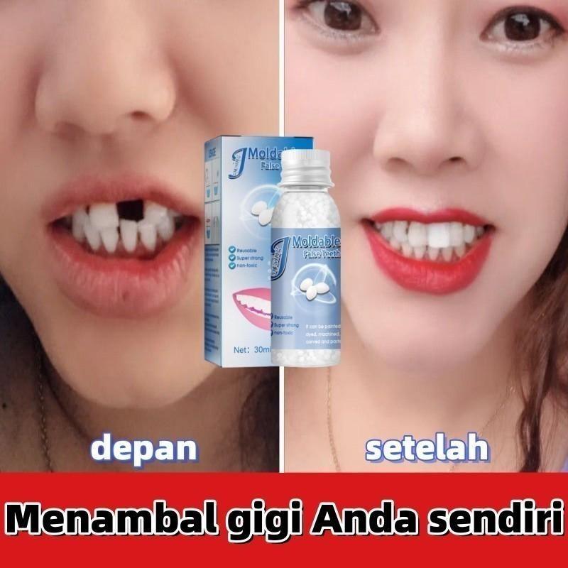 Dekorasi Gigi Gaya Film dan Televisi, Cairan Perbaikan Gigi Hilang yang Laris Dijual Meredakan Nyeri Gusi Ketidaknyamanan Mulut Pereda Sakit Gigi Perawatan Menyegarkan Perbaikan Pembersihan Perawatan Gigi Tetes Pereda Gigi