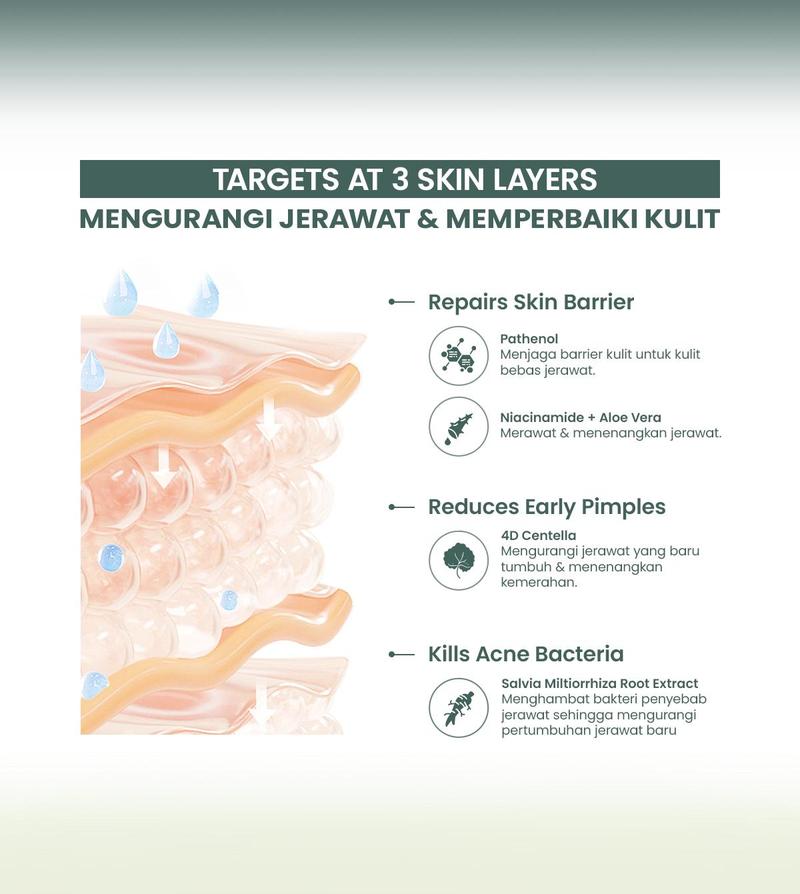 Product Introduction of ✨MJ 100% ORI✨ YOU AcnePlus Multi-Action Skin Cream | Moisturizer Anti Jerawat | Kulit Berminyak | Menghidrasi | Bebas Jerawat Treatment Wajah Berjerawat Perawatan Beruntusan 3