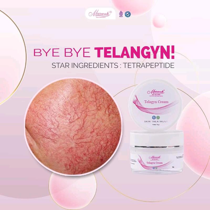 MARWAH TELANGYN CREAM/KRIM URAT/BPOM/HALAL/ORIGINAL 0