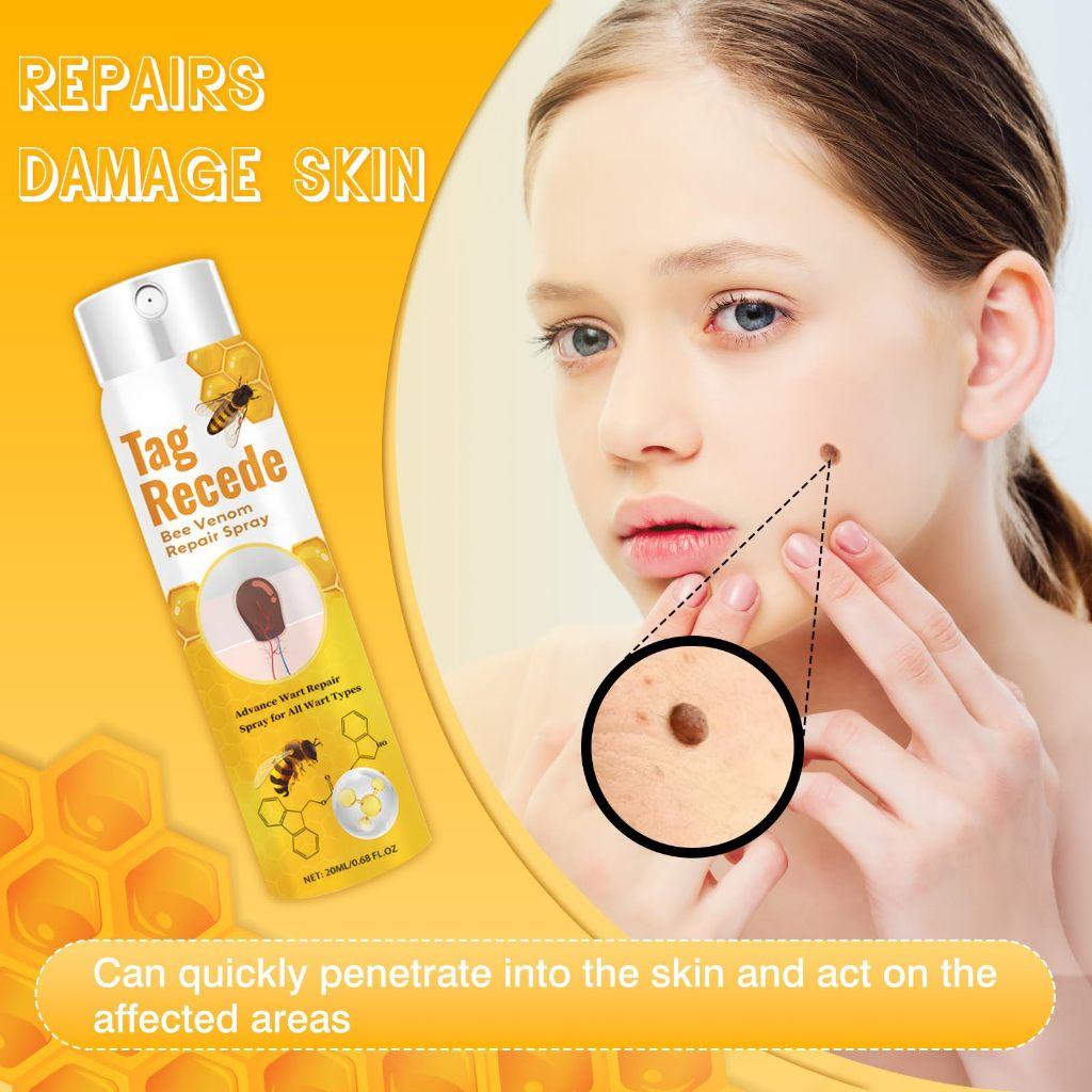 Penghilang Kutil Dan Tahi Lalat Obat Penghilang Kutil Penghilang Tahi Lalat Di Wajah Obat Kutil Ampuh Skin Tag Remover [S09]