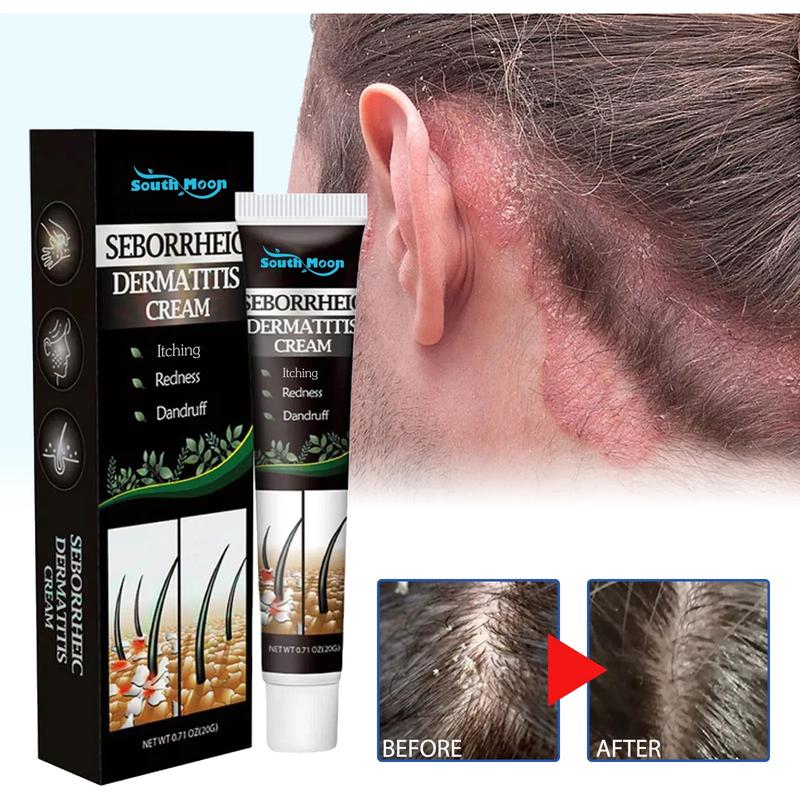 Product Introduction of Anti Dandruff Cream for Scalp Itching and Dandruff for Men & Women,anti Hair Loss Nourish Hair Fast Growth Cream,hair Treatments/Natural Cream for Psoriasi Eczma 20g 1