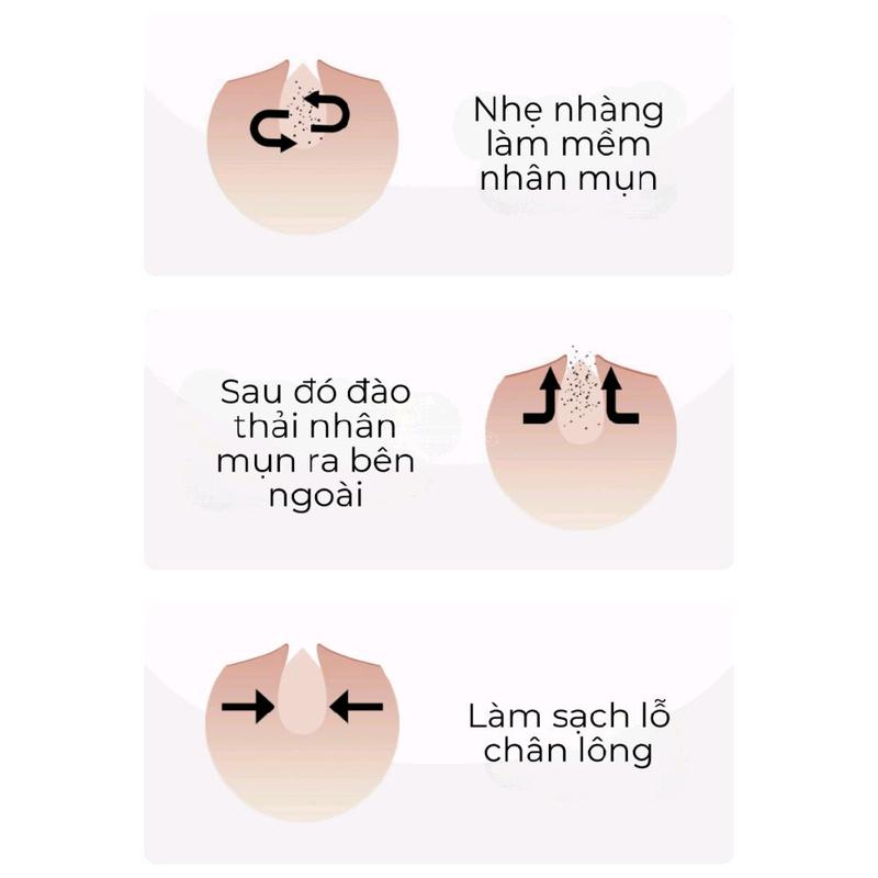 Gói Lột Mụn Đầu Đen Sadoer. 2