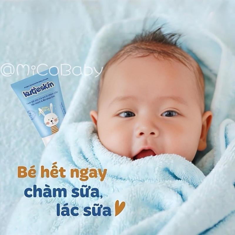 Kem bôi cho trẻ bị chàm sữa Kutieskin 30g Chính Hãng, an toàn cho bé từ sơ sinh kuti eskin 2