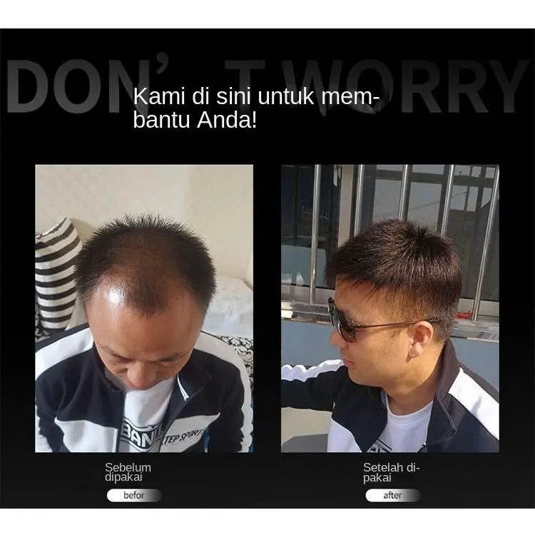 COD-Wig rambut pendek pria tampan, tipis dan bertanda pria botak pengganti rambut kepala pengganti rambut asli piece 2