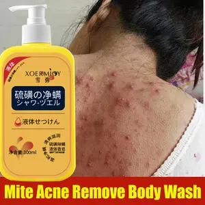 Sabun Cair Sulfur 300ml - Body Wash Khusus Jerawat Punggung & Tubuh | Atasi Bruntusan, Gatal & Minyak Berlebih | Formulasi Antibakteri, Membersihkan Pori & Menenangkan Kulit