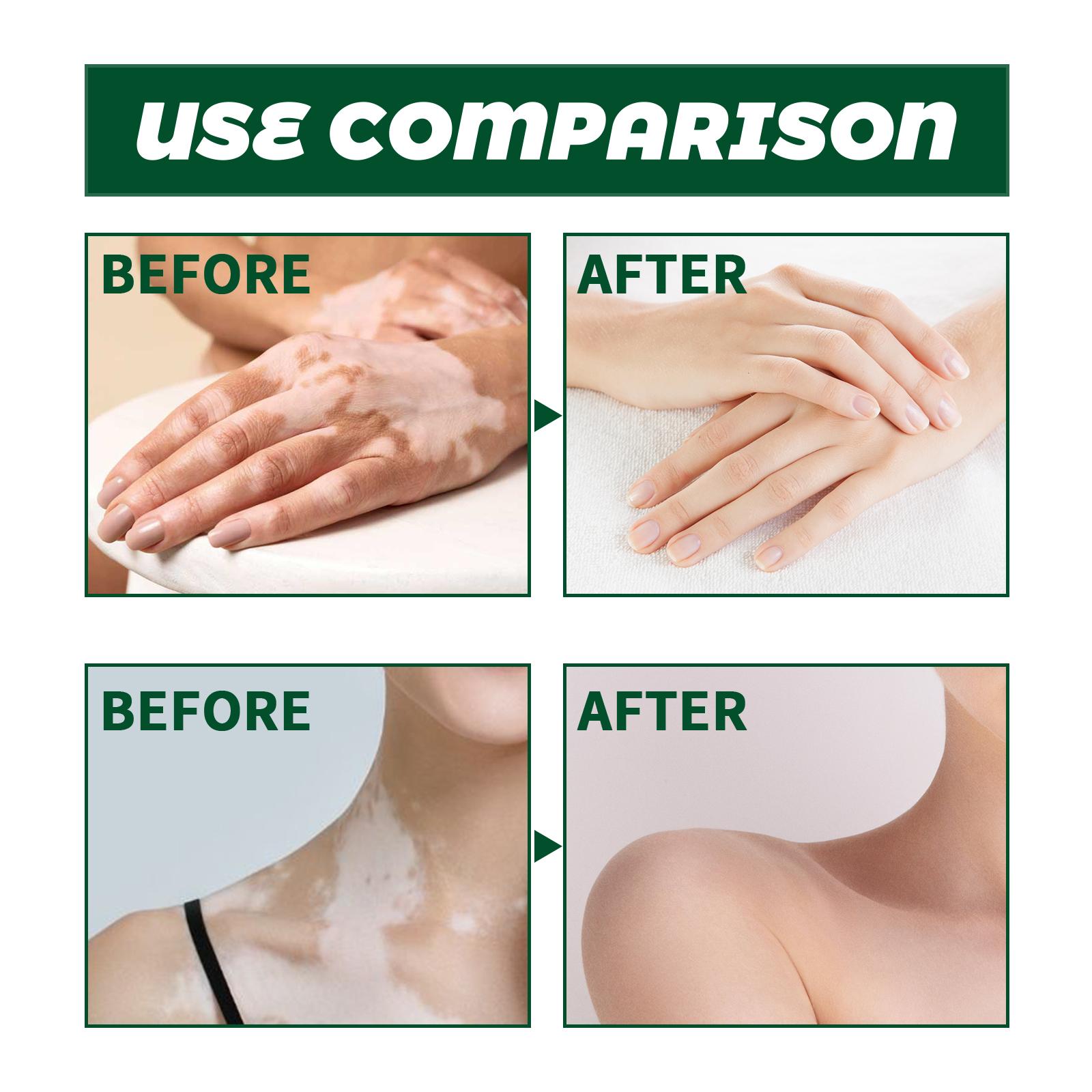 Pengiriman Cepat Prioritas Pengiriman Krim Perawatan Kulit South Moon Krim Perawatan Eksternal untuk Membersihkan, Melembapkan, dan Memperbaiki Kulit Tubuh Mengurangi Ketidaknyamanan