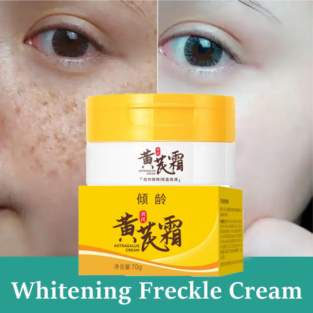 Original Melasma Remover Cream Astragalus Herbal Whitening Freckle Remover Cream Natural Chinese Herbal Pekas Remove Cream High Moisturizing Cream Blemish Cream Sunburn Freckle Removing Chloasma and Age Spots 70g