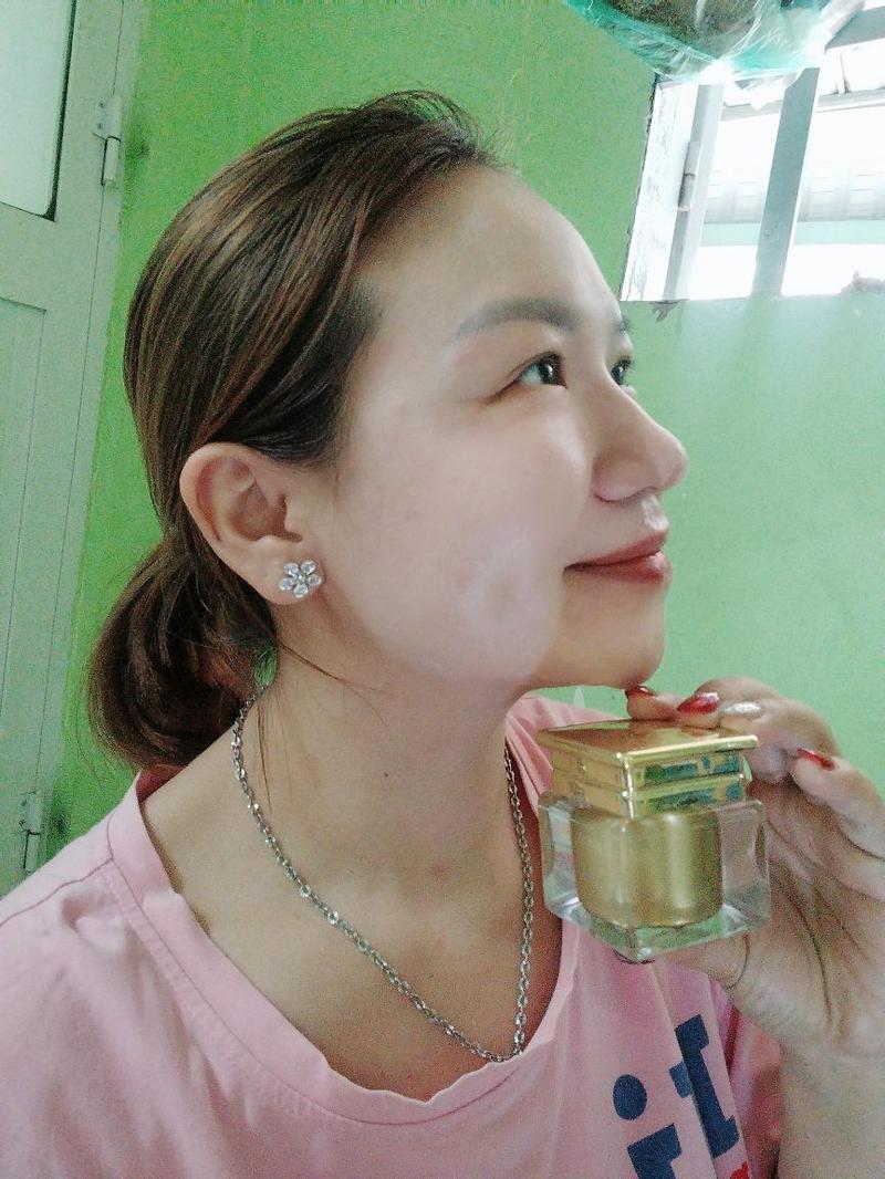 Product Introduction of KEM DƯỠNG TRẮNG SÁNG DA mờ thâm sạm nám tàn nhang đồi mồi 12