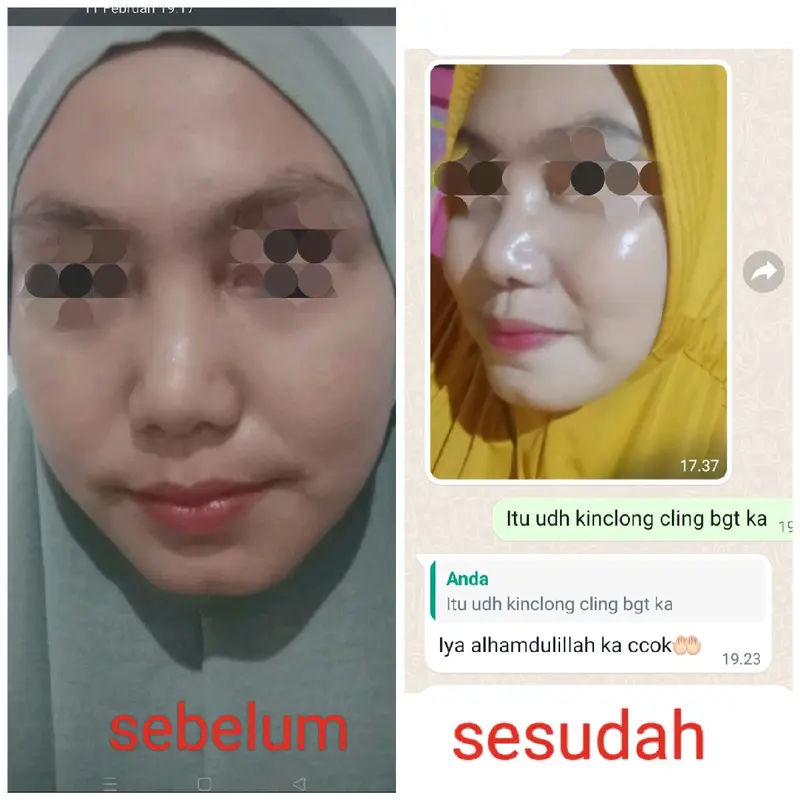 paket whitening kulit sensitif 2