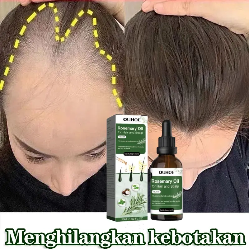 penumbuh rambut cepat dan tebal serum rambut rontok Hair growth serum ...