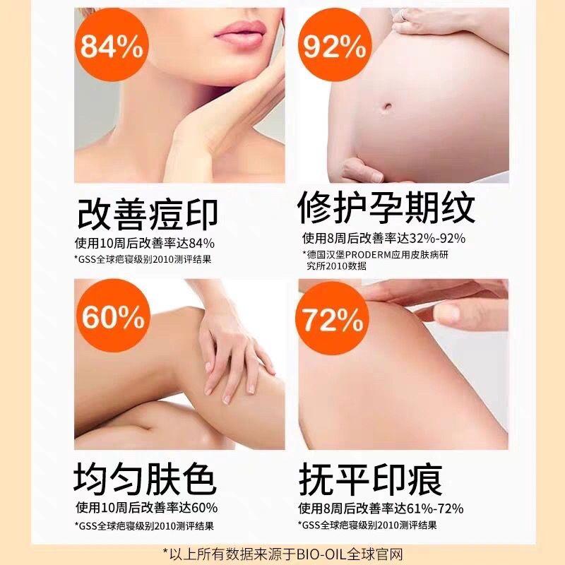 Product Introduction of Dầu Dưỡng Thể, BIO-OIL, Chăm Sóc Da Dưỡng Ẩm Cơ Thể, Tinh Dầu, Ngăn Ngừa Vết Co Giãn Da, Phục Hồi Vết Sẹo Nhẹ, Bổ Sung Độ Ẩm, Có Sẵn Cho Phụ Nữ Mang Thai, 200ml 10