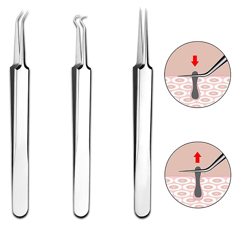 Nhíp Kẹp Mụn Trứng Cá Tế Bào, 8CM, Dụng Cụ Làm Đẹp, Chuyên Nghiệp, Chà Và Đóng, Dụng Cụ Trị Mụn, Đặc Biệt Cho Thẩm Mỹ Viện 1