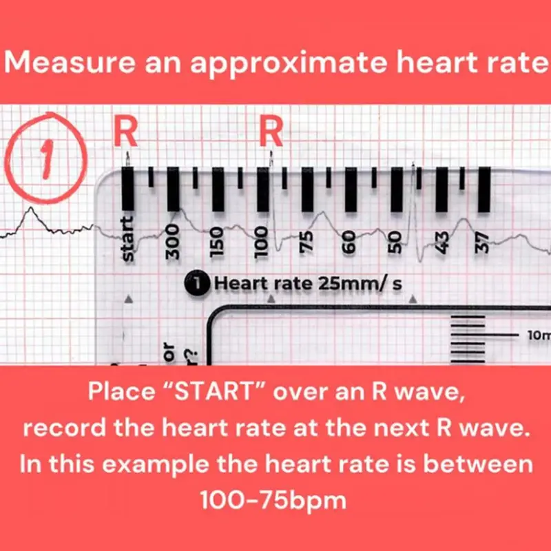 Thước 7 Bước, Cầm Tay, Hướng Dẫn Tham Khảo Bỏ Túi Giải Thích Ecg, Trong Suốt, Thiết Kế Nhỏ Gọn, Dụng Cụ Đánh Giá, Để Đo Lường 2