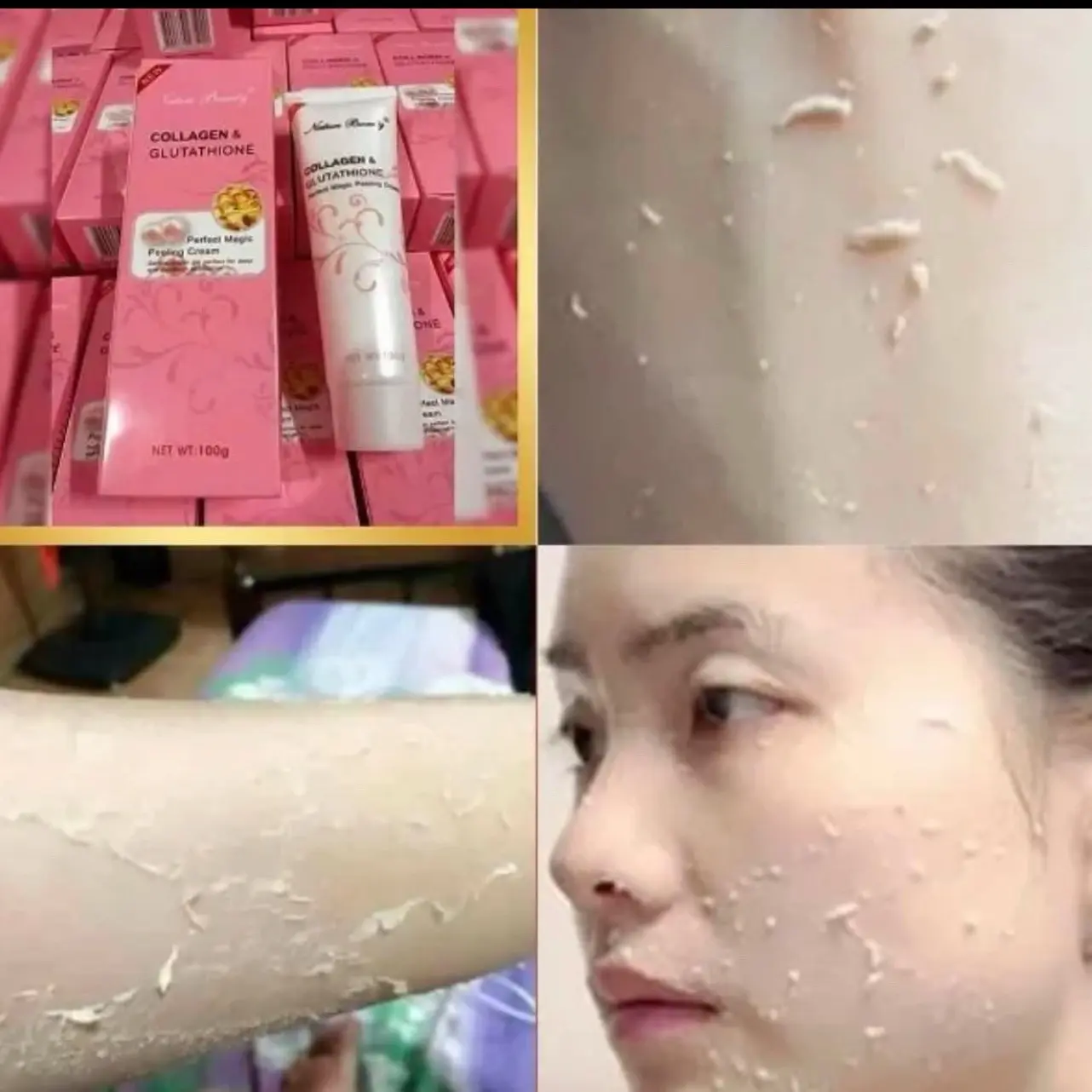 glutathione injection price uk Glutathione Injection