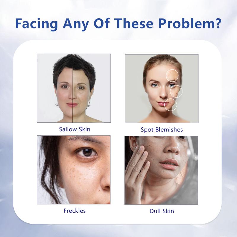 Product Introduction of 377 Snow Whitening Cream Freckles Removal Reduce Dark Spot 28