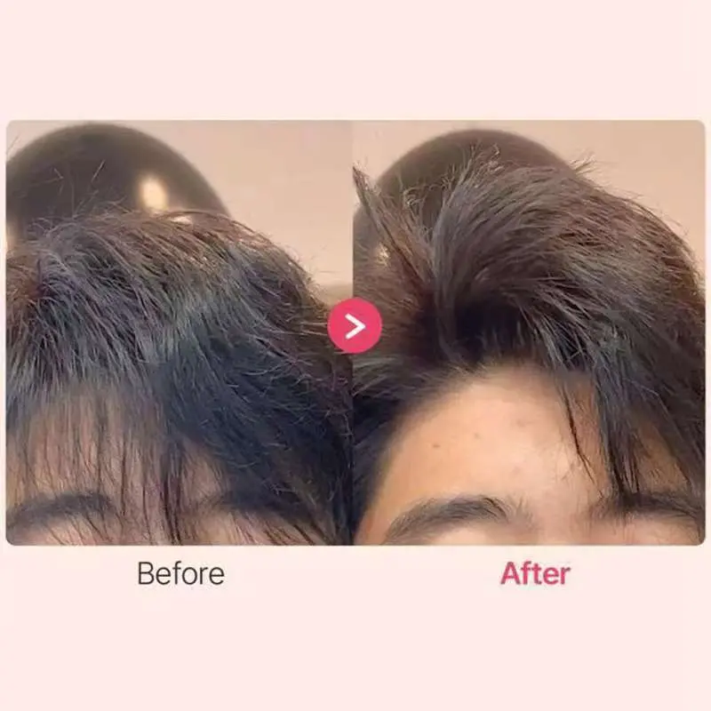[Bán chạy] Lược Làm Phồng Chân Tóc, Kẹp Tạo Phồng Chân Tóc Mái Thời Trang Hàn Quốc 3 Răng - 6 Răng Cho Nam Nữ   Kẹp tóc đệm kiểu tóc gió phiên bản nâng cấp 2.0 6