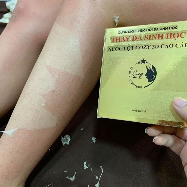 lột da body tay cổ cao cấp 30p kèm dưỡng ẩm , kích bong lần 2 6