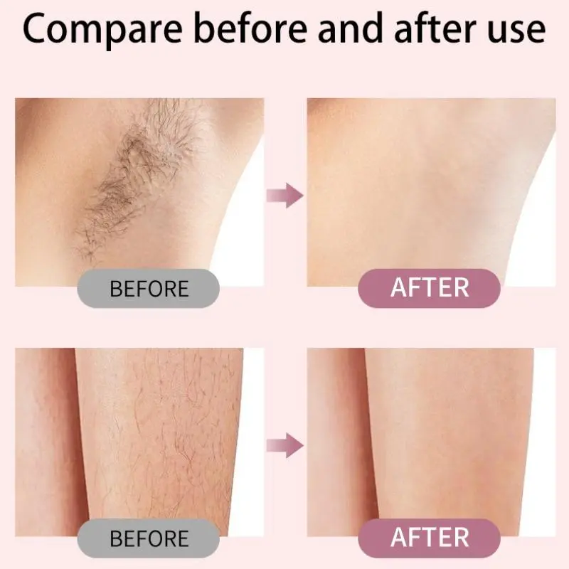 Electric Hair Trimmer, 1 Count Portable Rechargeable Hair Removal Tool for Women, Gentle Hair Removal Machine for Underarm, Bikini, Body, Face, Leg, Eyebrow 6